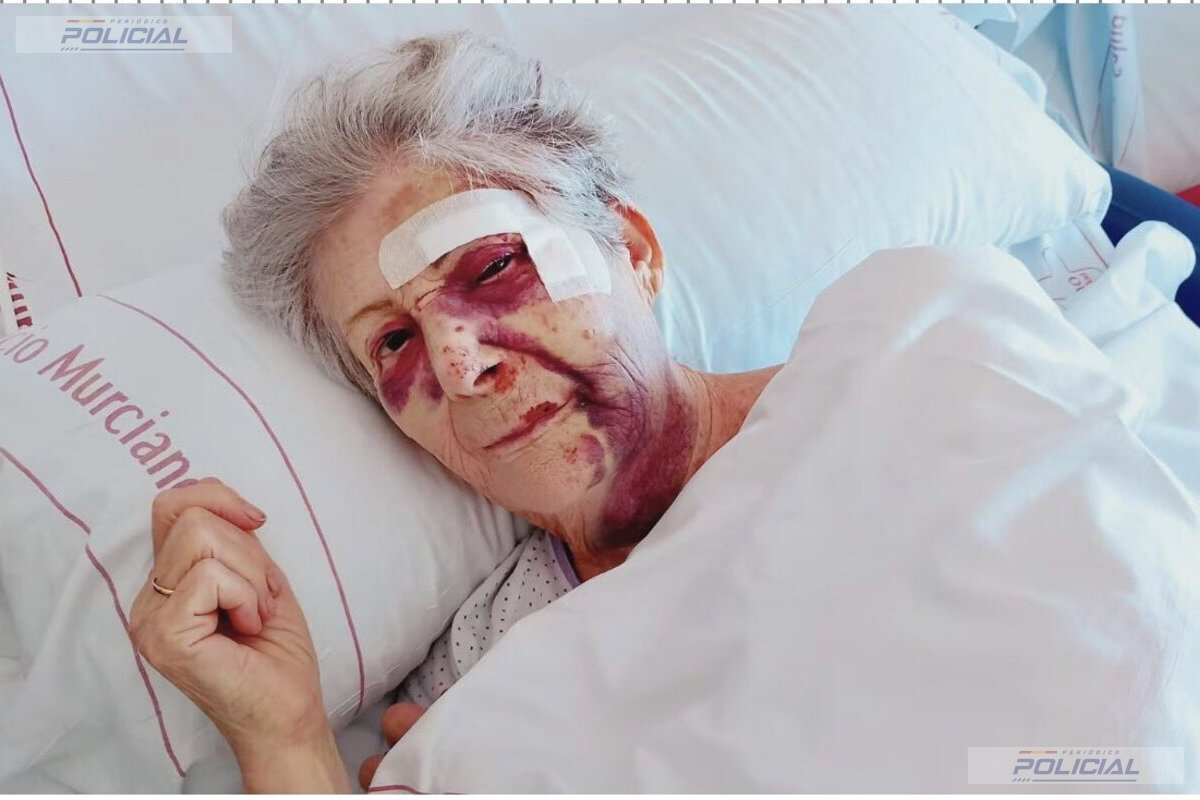 Una mujer de 80 años sufre una brutal agresión durante un robo en Santiago de la Ribera y permanece hospitalizada con graves lesiones faciales