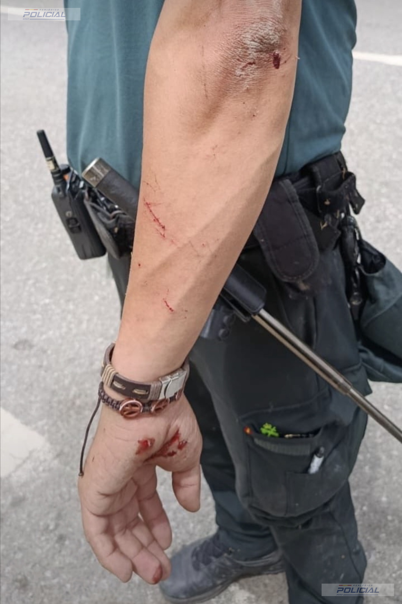 Un guardia civil resulta herido durante una intervención en el perímetro fronterizo de Ceuta