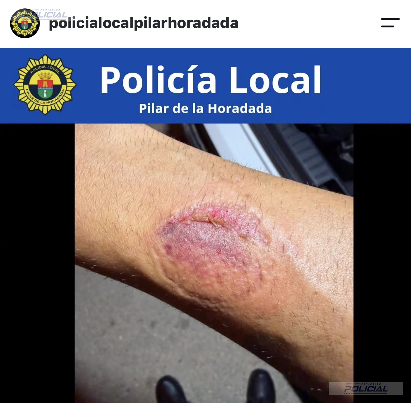 Detenida una conductora tras circular en sentido contrario, negarse a las pruebas y agredir a agentes en Pilar de la Horadada