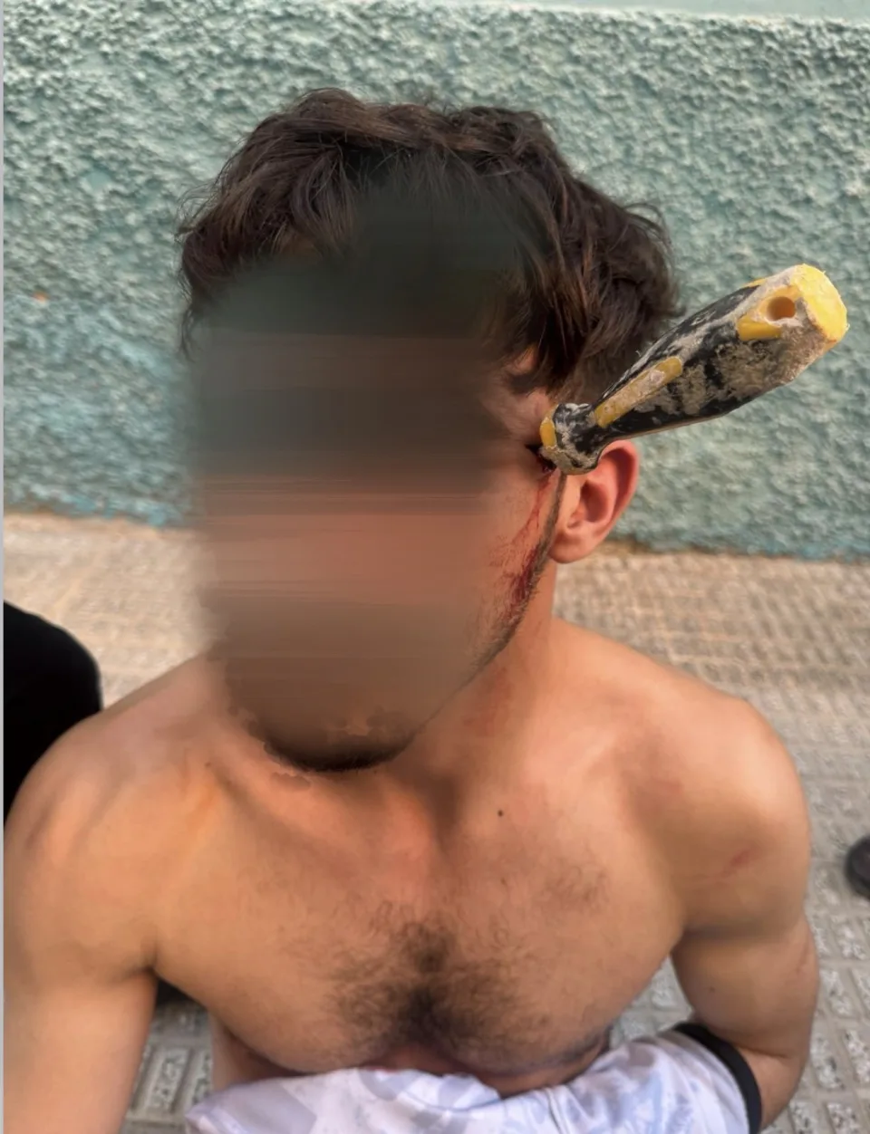 Un hombre herido con un destornillador clavado en la cabeza tras una violenta reyerta en Albatera